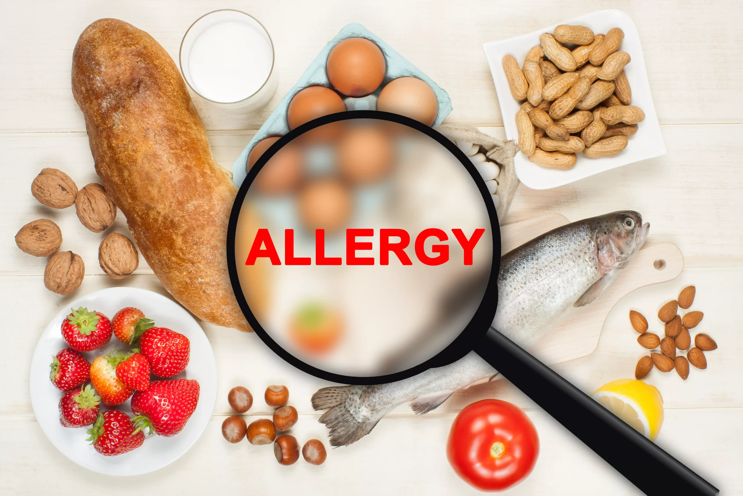 Allergies and Nutrition